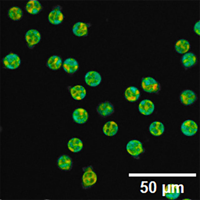 fluorescence lifetime imaging microscopy